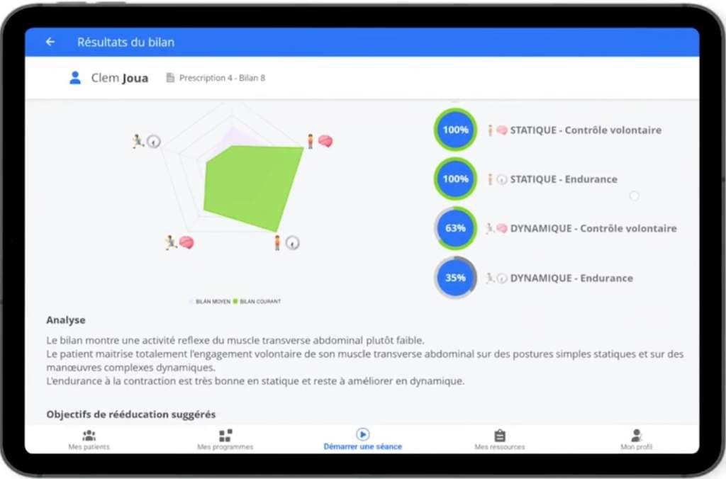 Graphique d'analyse de la force musculaire périnéale avec Inner Up.