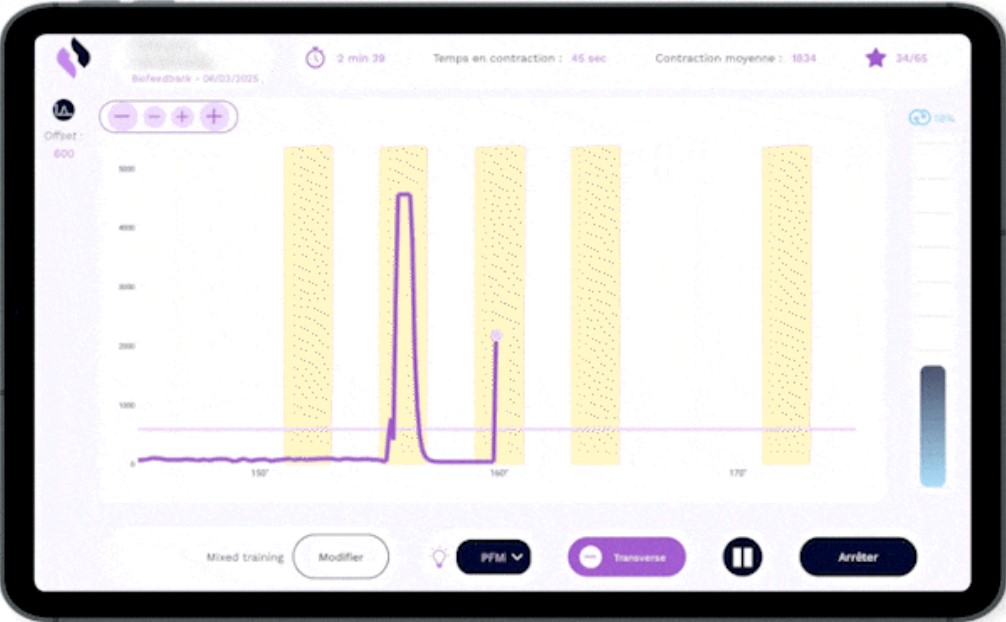 Graphique de biofeedback utilisé en rééducation périnéale Inner Up à Nice, montrant l’intensité et les pics de contraction du plancher pelvien.